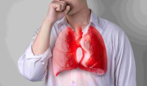 COVID-19重症化阻害薬(ALKAL1阻害剤)